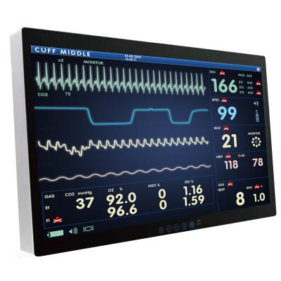 Onyx 32" 4K-UHD Medical LCD Monitor